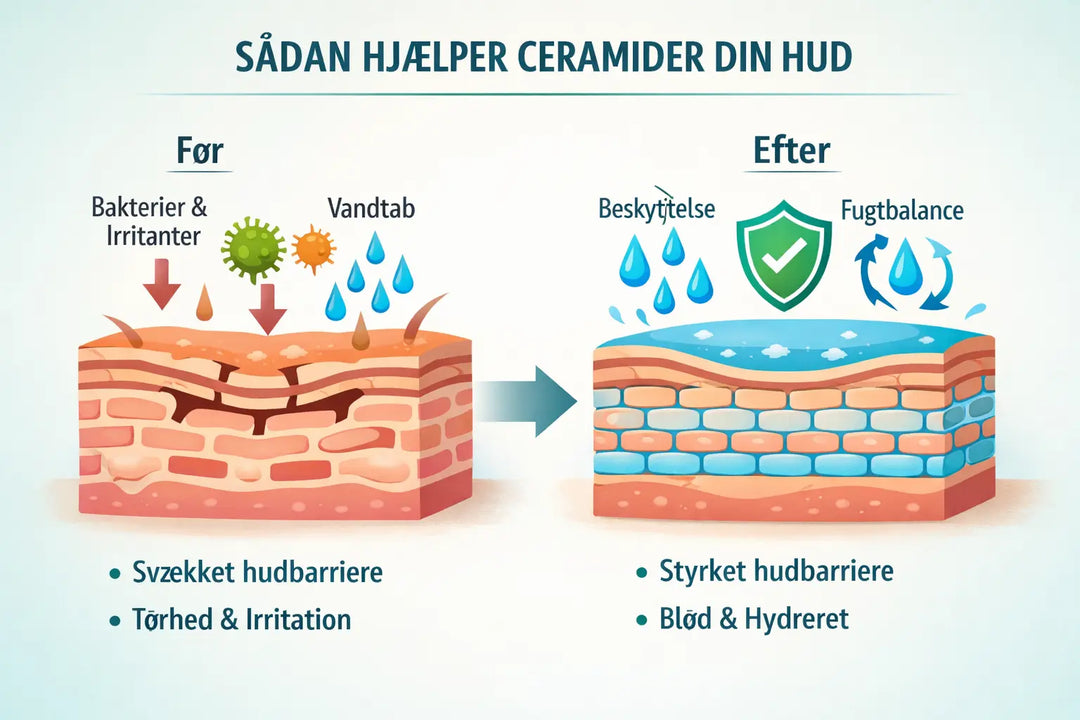Hjælper ceramider mod tør hud?