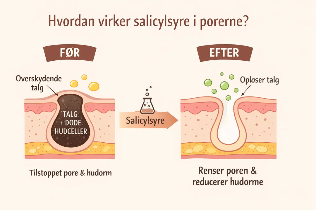 Hvad er Salicylsyre (BHA)? | Guide til hudorme og uren hud | K-Beauty Danmark