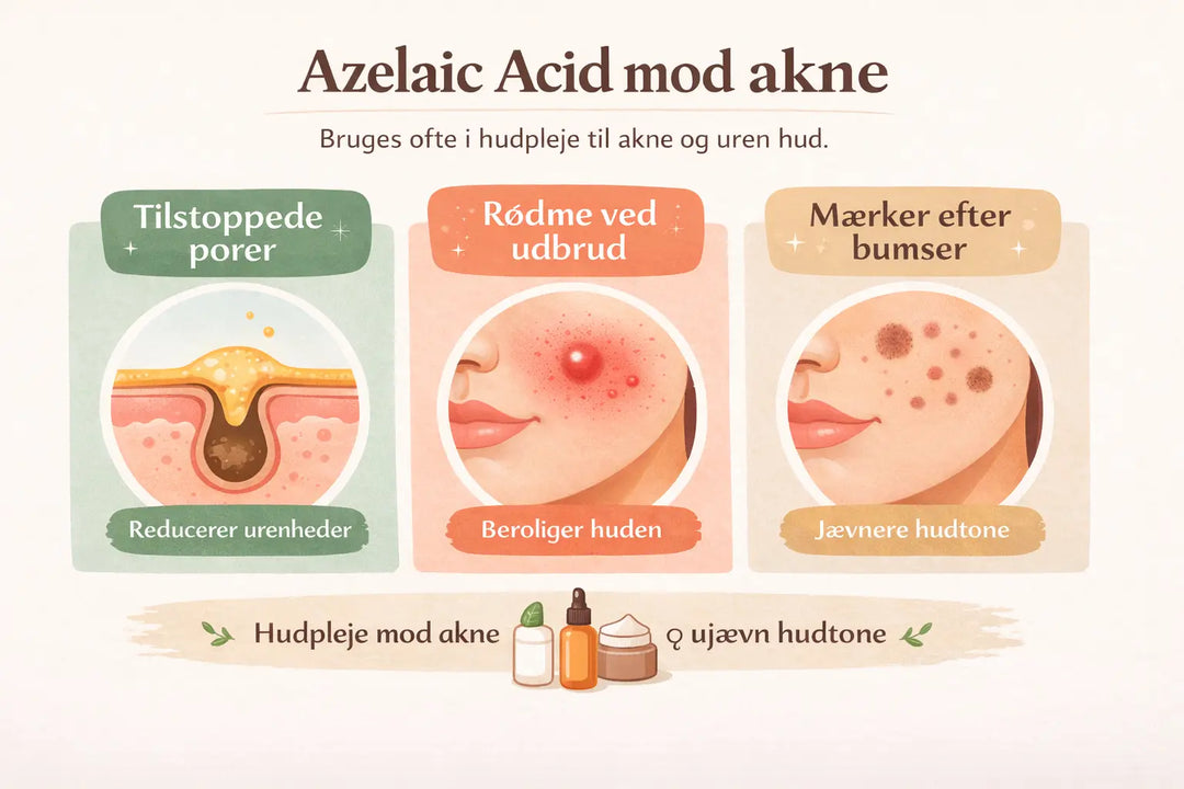Azelaic Acid mod akne