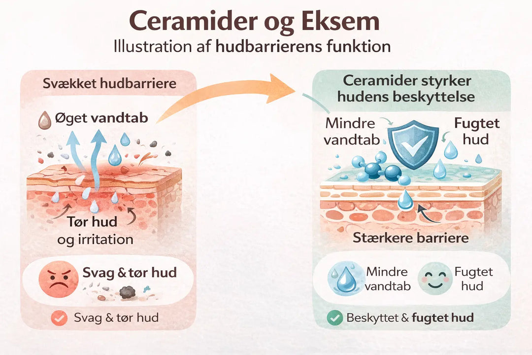 Ceramider og eksem – hvorfor de er vigtige for hudbarrieren