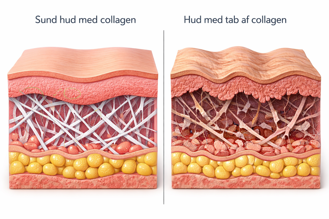Hvordan beskytter og bevarer man hudens collagen?