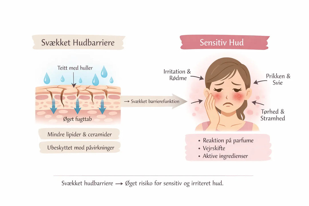 Er squalane godt til sensitiv hud?