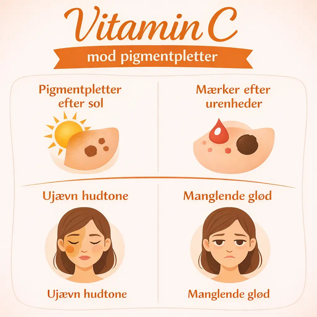  Vitamin C hudpleje mod pigmentpletter
